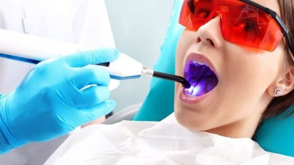 Laserterapia na odontologia Laserterapia na odontologia